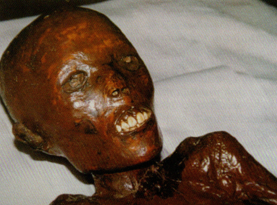 Em 1997, durante novo exame a múmia apresentava esse aspecto